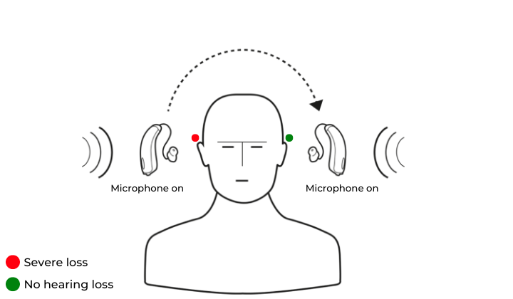 Phonak CROS Lumity